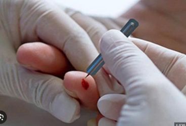 CHÍCH LỂ TRONG Y HỌC CỔ TRUYỀN CHÍCH LỂ TRONG Y HỌC CỔ TRUYỀN
